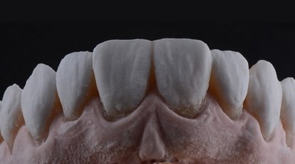 Reabilitação Dentogengival